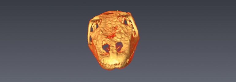 Skull Image